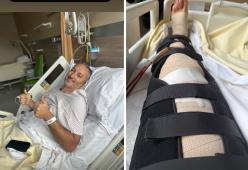 Gianluca Zambrotta sotto i ferri per il varismo alle gambe: come sta