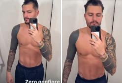 Zelletta si sottopone a un trapianto di capelli: “Ero insicuro”