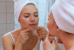 Come schiacciare un brufolo senza creare danni alla pelle