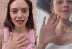 Francesca Michielin tranquillizza i fan dopo l’operazione