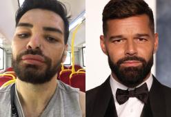 40 interventi di chirurgia estetica per essere Ricky Martin: la storia
