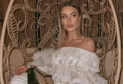 Sophie Codegoni e la chirurgia estetica: "Ho iniziato a 16 anni"