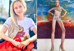Spende 150mila per farsi allungare le gambe: l’incredibile storia