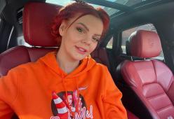 La storia della modella che si rifà il seno e lo scarica in tasse