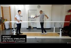 Paraplegici tornano a camminare grazie ad una tecnica di stimolazione wireless