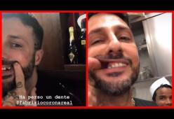 Fabrizio Corona perde un dente, lo trova nella spazzatura e lo rimette a posto