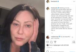 Shannen Doherty: “Ho vissuto e sofferto, il mio volto riflette la mia esistenza”