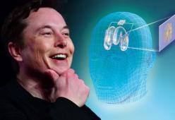 Musk pensa a installare un chip nel cervello umano 
