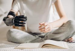 Davide: il ragazzo con un braccio bionico che studia per diventare prof di ginnastica
