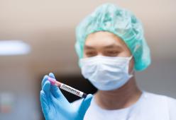 Se la popolazione non è immune il caldo e l’umidità non fermano il Coronavirus: lo rivela uno studio