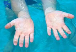 Come mai se stai troppo in acqua le dita raggrinziscono? 
