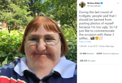 Melissa Blake affetta da una malattia rara ha sommerso i social con i suoi selfie per vendicarsi degli insulti 