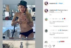 Madonna: selfie esplosivo in topless e con la stampella