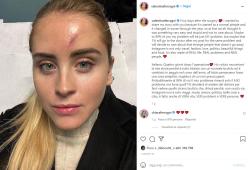 Valentina Ferragni racconta la sua operazione al viso: forse a causa di un tumore
