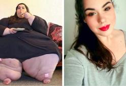 Da Vite al Limite 10 trasformazioni epiche di ex obesi gravi