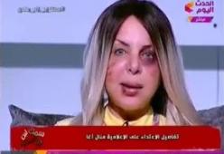 Iniziativa shock di una giornalista egiziana: si presenta in video con il volto tumefatto