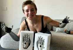 Bebe Vio e le sue “nuove mani bioniche”
