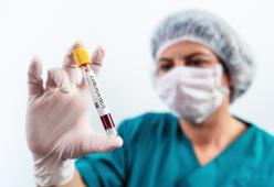 Rischio di danni permanenti alle vie respiratorie per il 30% dei guariti dal Covid-19