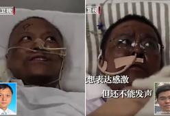 Due medici cinesi contagiati a Wuhan si sono risvegliati con la pelle scura