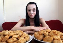 26enne mangia solo crocchette di pollo e patatine a causa di un raro disturbo alimentare