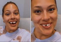 Ashley Graham si fa male con un biscotto congelato e rimane sdentata