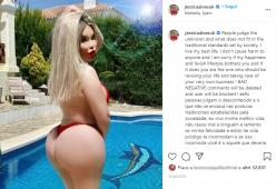 "Sedere come J-Lo e fianchi da Kim Kardashian": l'ex Ken umano dopo l'ultima operazione
