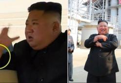 Kim Jong-un torna in pubblico con uno strano segno sul braccio