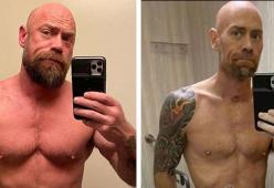 Paziente posta le foto choc del prima e dopo il suo ricovero per Covid-19