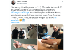 Patrick Paumen: l’uomo cyborg con 32 chip sottopelle