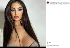 Modella sperpera 600mila dollari per assomigliare a Kim Kardashian ma ora è pentita