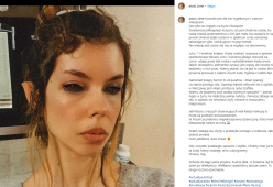A 21 anni perde la vista a causa di un tatuaggio sbagliato