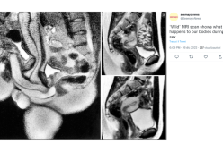 Fanno sesso durante la risonanza magnetica, ma in nome della scienza