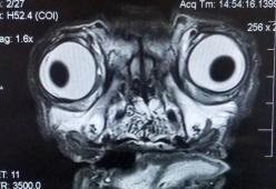 Questa radiografia (inquietante) mostra tutti i problemi di un Carlino