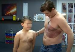 Questo papà si è fatto tatuare la stessa voglia di suo figlio per solidarietà