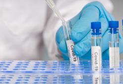 I Test sierologici presto saranno disponibili nelle farmacie