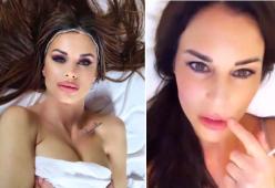 Antonella Mosetti rimuove l'acido ialuronico dalle labbra: "Erano enormi"