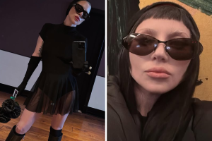 Lady Gaga: “Ho avuto una psicosi che mi ha allontanata dalla realtà”