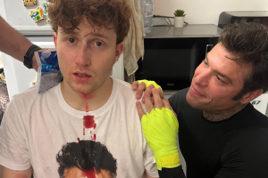 Fedez rompe il naso a Il Rosso durante uno sparring in diretta live