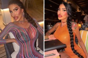 “Ho speso 110 mila€ in interventi estetici per diventare una Barbie”