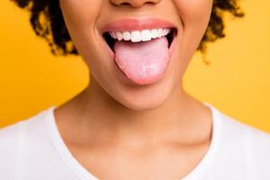 Scoperta una misteriosa molecola che vive nella nostra bocca