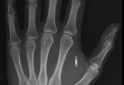 Chip impiantato nella mano: il mago dimentica la password