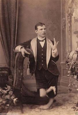  L’uomo aragosta. 
