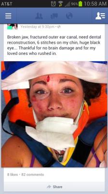  Il selfie dopo l’incidente. 