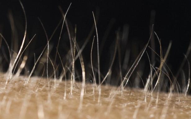 Muscoli erettori del pelo
