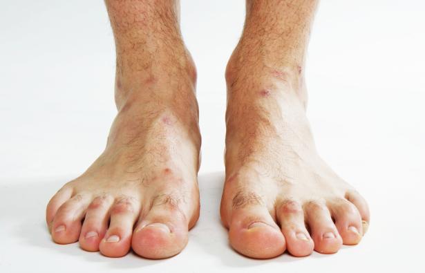  I piedi