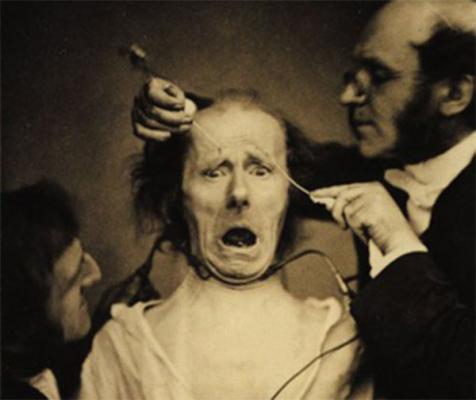 Terapia dell’avversione per omosessuali