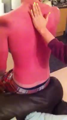 Mai, mai, mai toccare un ustionato!