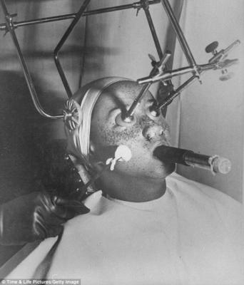 Un trattamento di bellezza anti-lentiggini del 1930