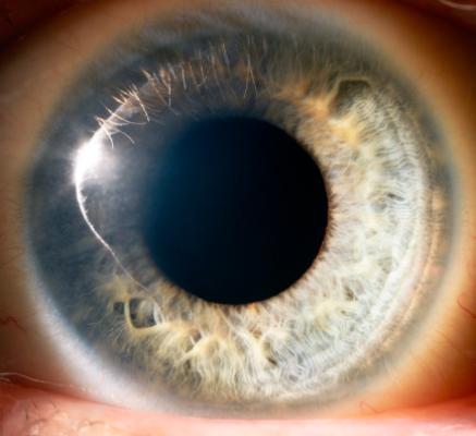 2. Dilatazione delle pupille